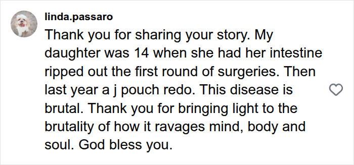 Joe Manganiello Shares Graphic Details Of Struggles After Major Amputation Amid Life-Threatening Health Battle