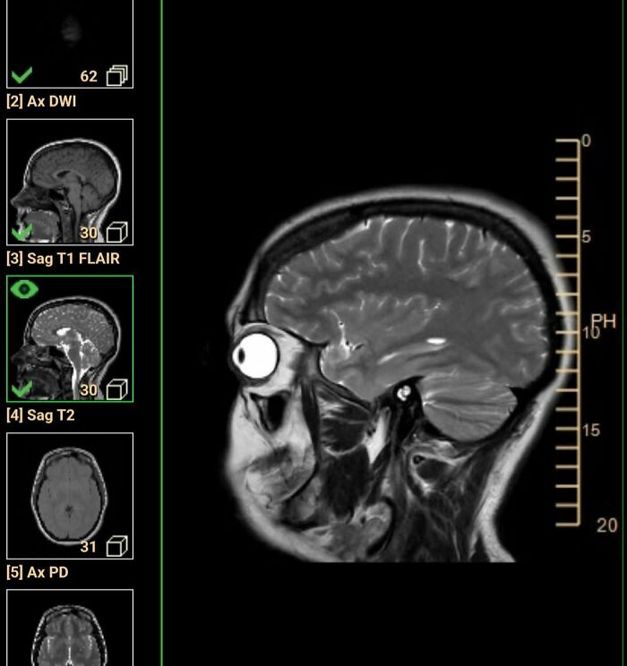 44 Interesting, Cool And A Bit Disturbing Medical Photos And Stories 44 Interesting, Cool And A Bit Disturbing Medical Photos And Stories