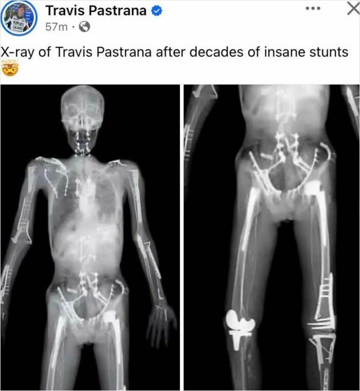44 Interesting, Cool And A Bit Disturbing Medical Photos And Stories 44 Interesting, Cool And A Bit Disturbing Medical Photos And Stories