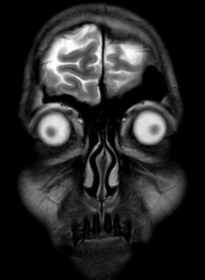 44 Interesting, Cool And A Bit Disturbing Medical Photos And Stories 44 Interesting, Cool And A Bit Disturbing Medical Photos And Stories