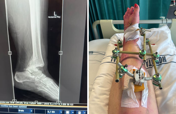 44 Interesting, Cool And A Bit Disturbing Medical Photos And Stories 44 Interesting, Cool And A Bit Disturbing Medical Photos And Stories