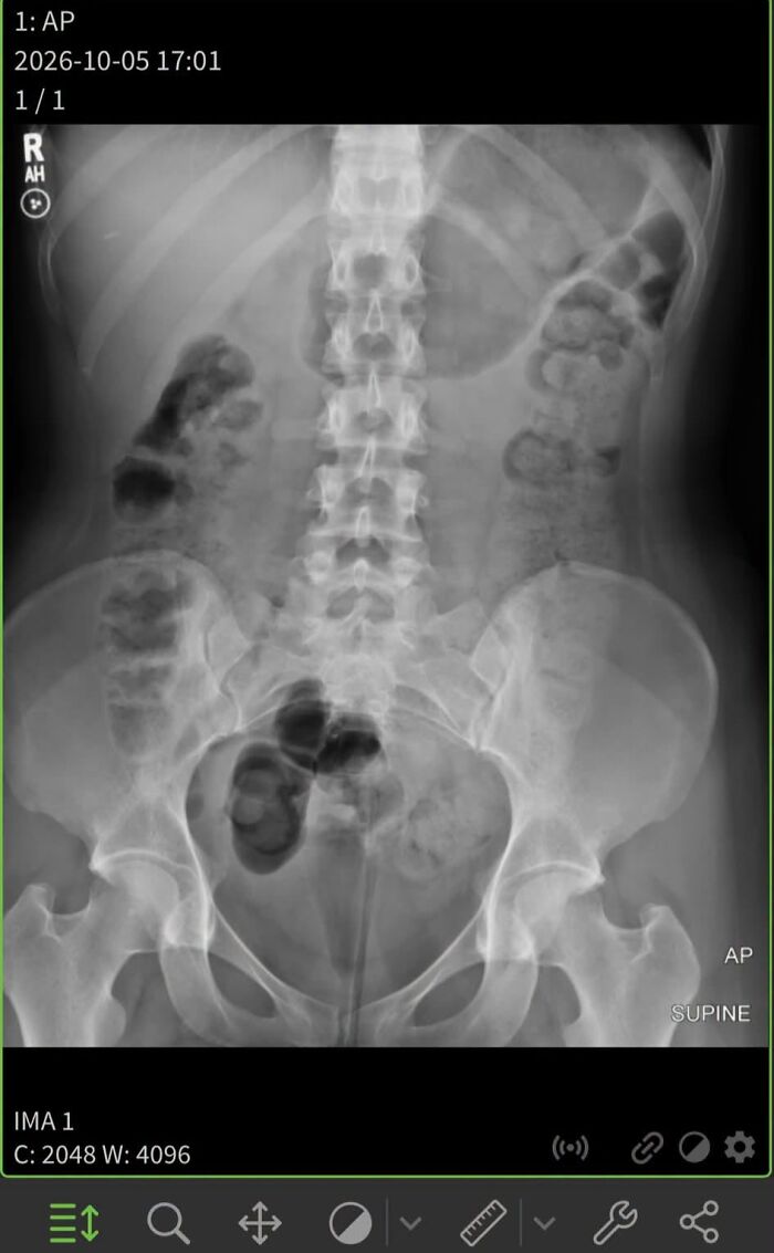 44 Interesting, Cool And A Bit Disturbing Medical Photos And Stories 44 Interesting, Cool And A Bit Disturbing Medical Photos And Stories