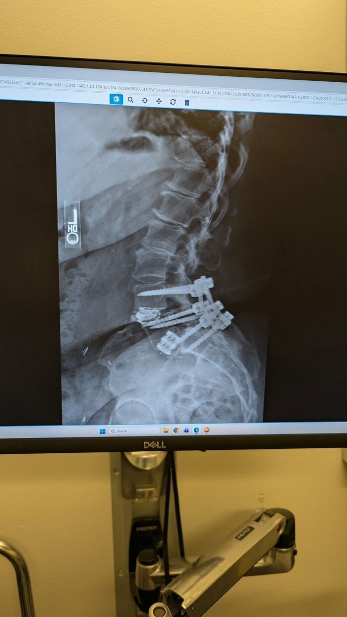 44 Interesting, Cool And A Bit Disturbing Medical Photos And Stories 44 Interesting, Cool And A Bit Disturbing Medical Photos And Stories