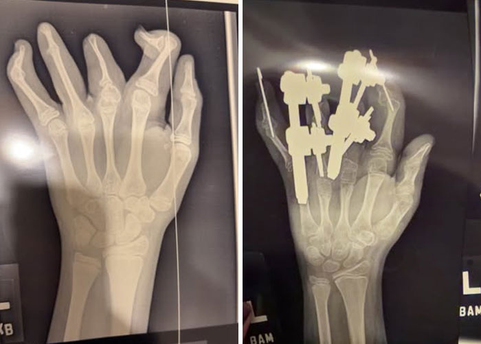 44 Interesting, Cool And A Bit Disturbing Medical Photos And Stories 44 Interesting, Cool And A Bit Disturbing Medical Photos And Stories