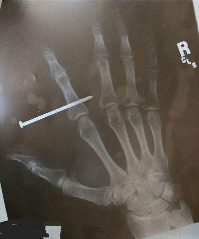 44 Interesting, Cool And A Bit Disturbing Medical Photos And Stories 44 Interesting, Cool And A Bit Disturbing Medical Photos And Stories