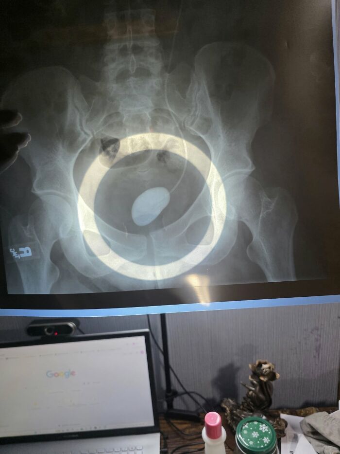 44 Interesting, Cool And A Bit Disturbing Medical Photos And Stories 44 Interesting, Cool And A Bit Disturbing Medical Photos And Stories
