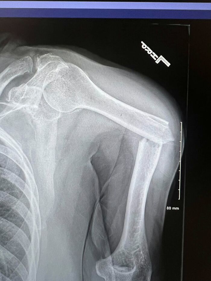 44 Interesting, Cool And A Bit Disturbing Medical Photos And Stories 44 Interesting, Cool And A Bit Disturbing Medical Photos And Stories