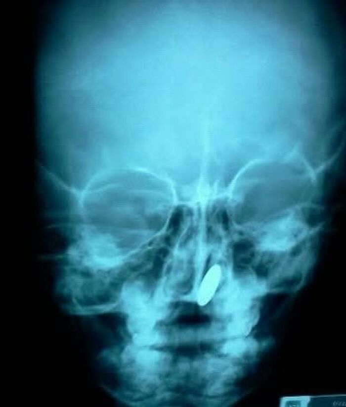 44 Interesting, Cool And A Bit Disturbing Medical Photos And Stories 44 Interesting, Cool And A Bit Disturbing Medical Photos And Stories