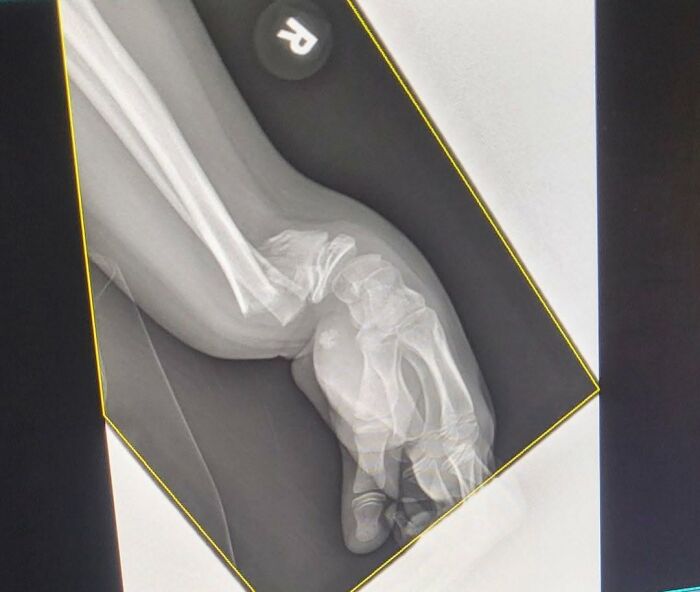 44 Interesting, Cool And A Bit Disturbing Medical Photos And Stories 44 Interesting, Cool And A Bit Disturbing Medical Photos And Stories