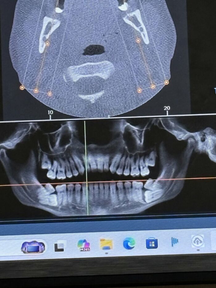 44 Interesting, Cool And A Bit Disturbing Medical Photos And Stories 44 Interesting, Cool And A Bit Disturbing Medical Photos And Stories