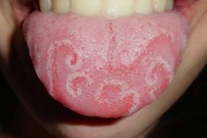 44 Interesting, Cool And A Bit Disturbing Medical Photos And Stories 44 Interesting, Cool And A Bit Disturbing Medical Photos And Stories
