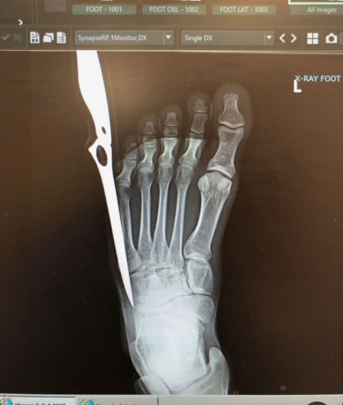 44 Interesting, Cool And A Bit Disturbing Medical Photos And Stories 44 Interesting, Cool And A Bit Disturbing Medical Photos And Stories