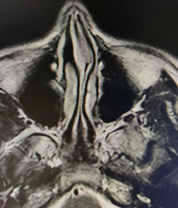 44 Interesting, Cool And A Bit Disturbing Medical Photos And Stories 44 Interesting, Cool And A Bit Disturbing Medical Photos And Stories