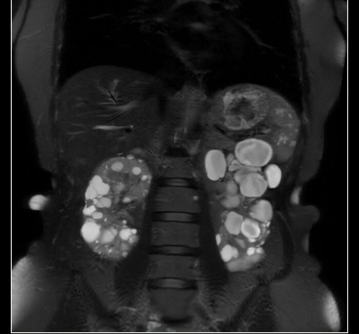 44 Interesting, Cool And A Bit Disturbing Medical Photos And Stories 44 Interesting, Cool And A Bit Disturbing Medical Photos And Stories