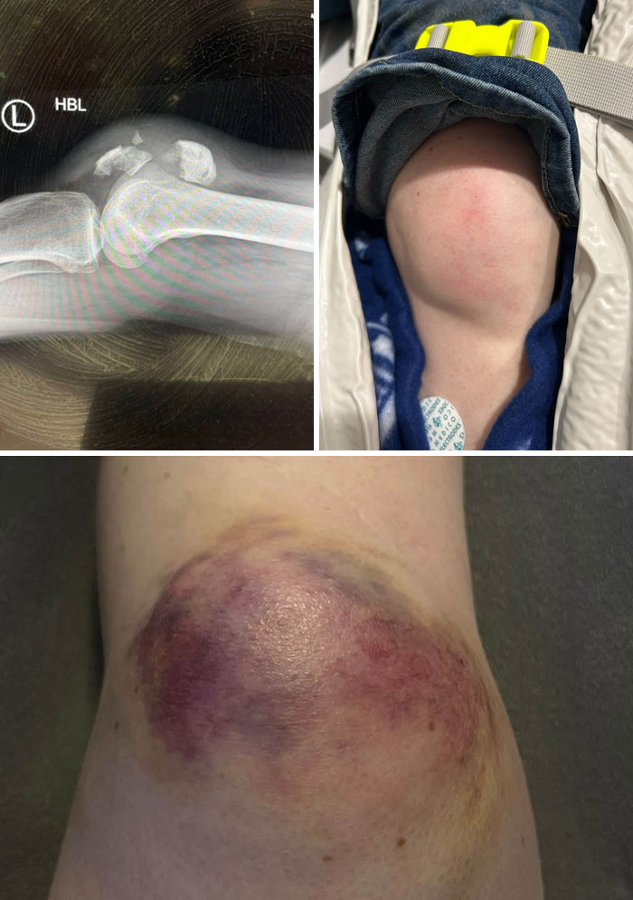 44 Interesting, Cool And A Bit Disturbing Medical Photos And Stories 44 Interesting, Cool And A Bit Disturbing Medical Photos And Stories