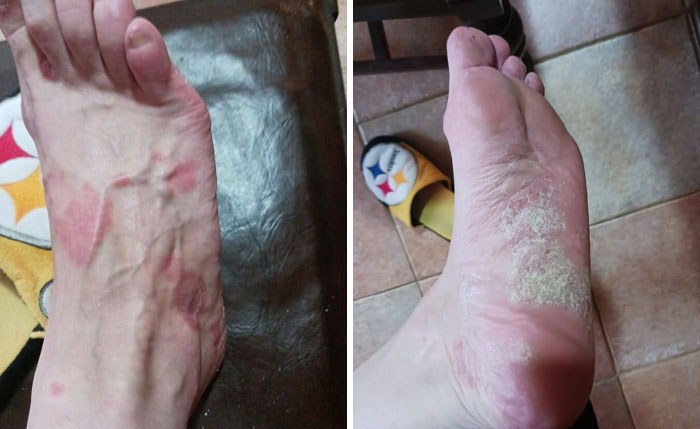 44 Interesting, Cool And A Bit Disturbing Medical Photos And Stories 44 Interesting, Cool And A Bit Disturbing Medical Photos And Stories