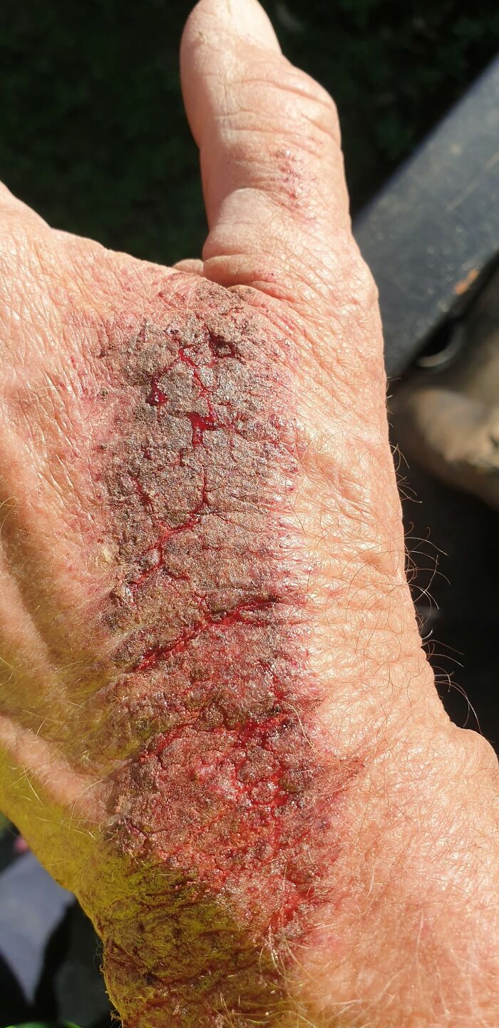 44 Interesting, Cool And A Bit Disturbing Medical Photos And Stories 44 Interesting, Cool And A Bit Disturbing Medical Photos And Stories