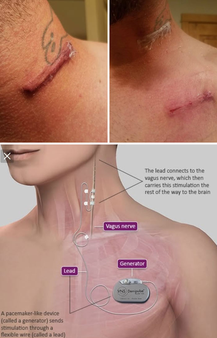 44 Interesting, Cool And A Bit Disturbing Medical Photos And Stories 44 Interesting, Cool And A Bit Disturbing Medical Photos And Stories