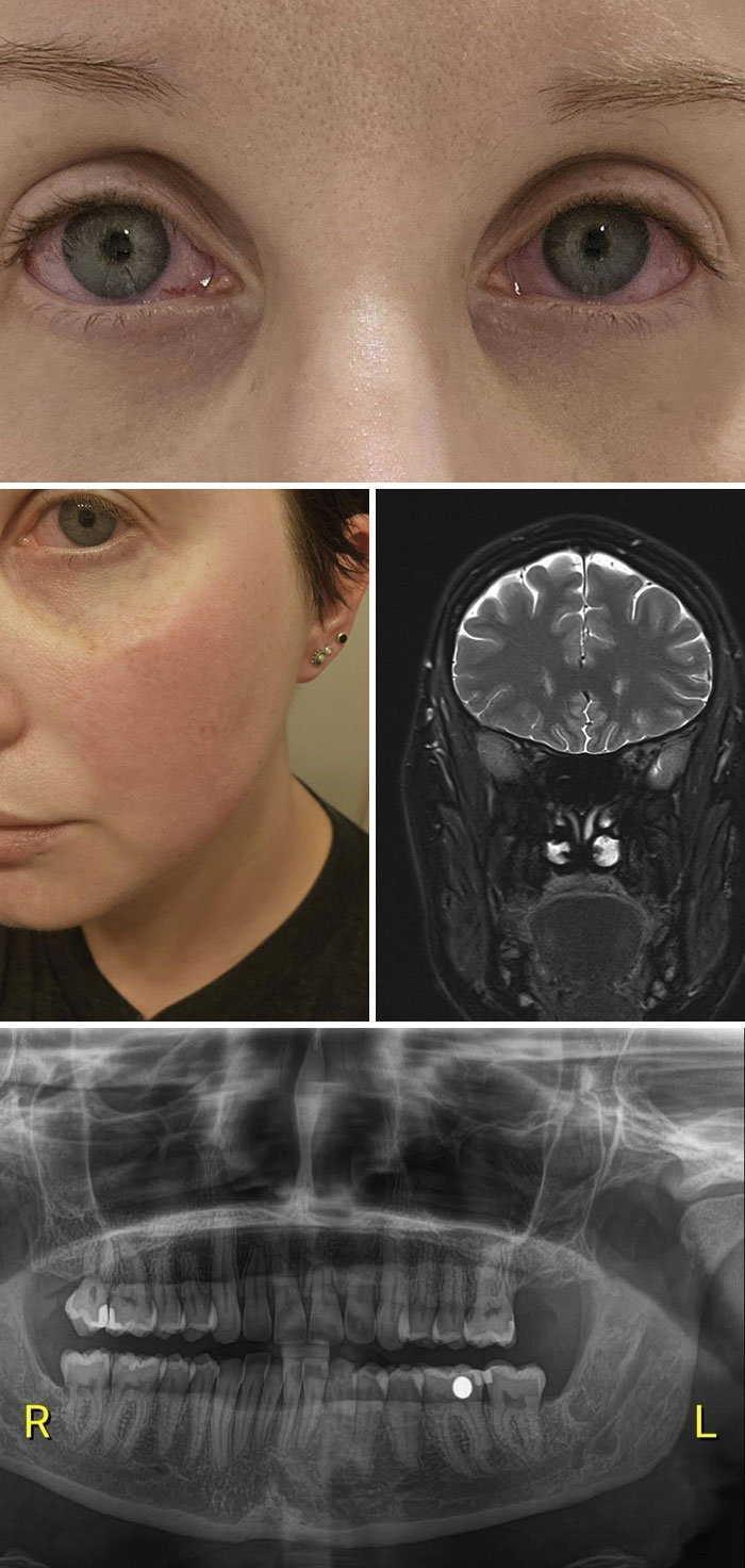 44 Interesting, Cool And A Bit Disturbing Medical Photos And Stories 44 Interesting, Cool And A Bit Disturbing Medical Photos And Stories