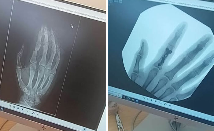 44 Interesting, Cool And A Bit Disturbing Medical Photos And Stories 44 Interesting, Cool And A Bit Disturbing Medical Photos And Stories