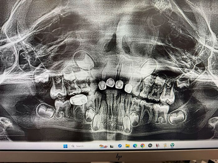 44 Interesting, Cool And A Bit Disturbing Medical Photos And Stories 44 Interesting, Cool And A Bit Disturbing Medical Photos And Stories