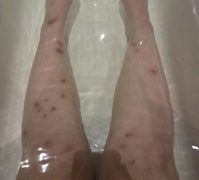 44 Interesting, Cool And A Bit Disturbing Medical Photos And Stories 44 Interesting, Cool And A Bit Disturbing Medical Photos And Stories