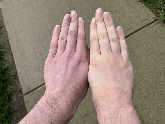 66 Photos Of Human Anatomy Reveal Real Body Features That Seem Almost Impossible At First Glance