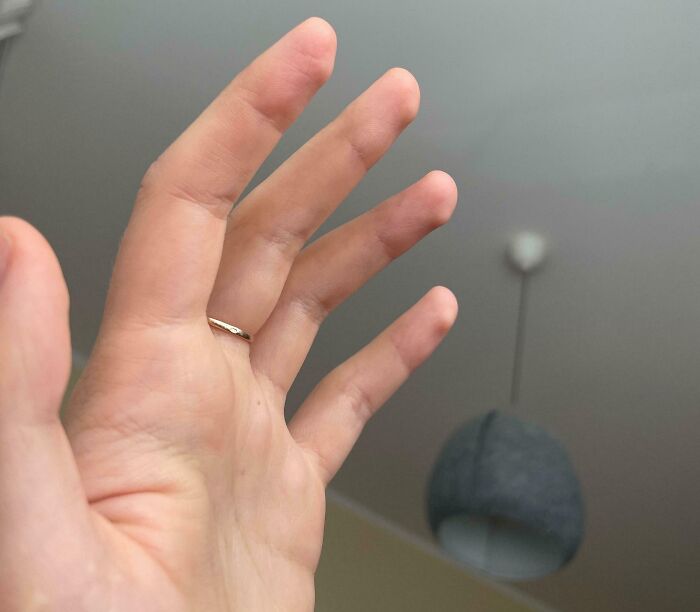 66 Photos Of Human Anatomy Reveal Real Body Features That Seem Almost Impossible At First Glance