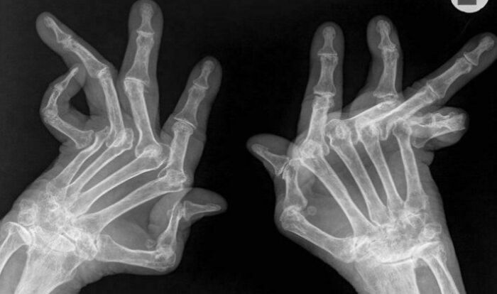 66 Photos Of Human Anatomy Reveal Real Body Features That Seem Almost Impossible At First Glance