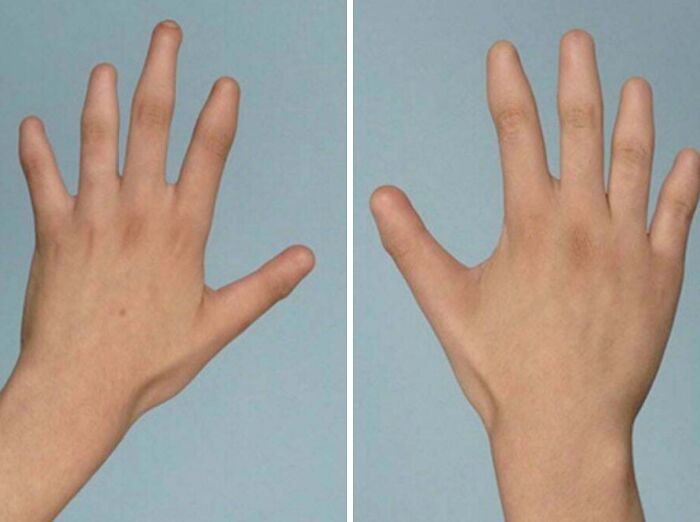 66 Photos Of Human Anatomy Reveal Real Body Features That Seem Almost Impossible At First Glance