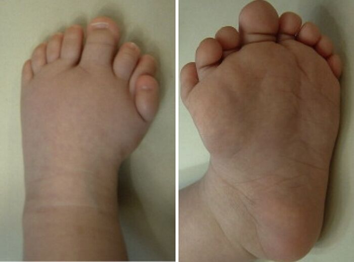 66 Photos Of Human Anatomy Reveal Real Body Features That Seem Almost Impossible At First Glance