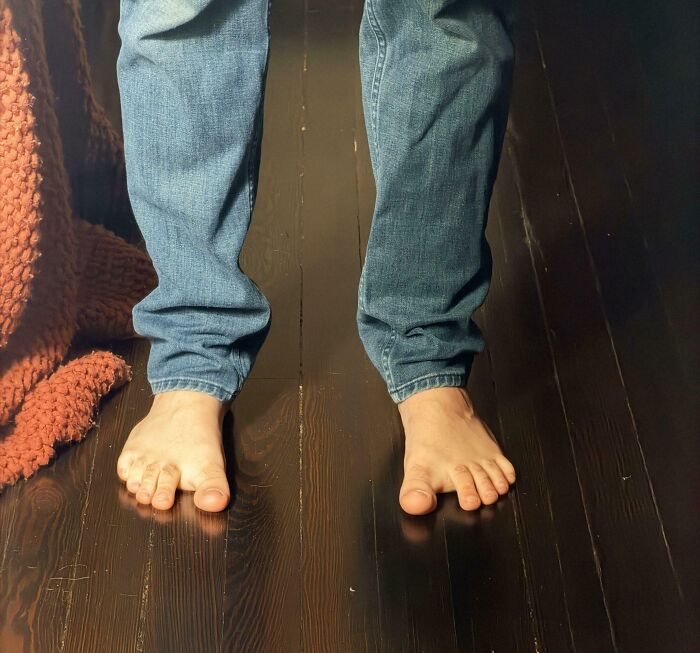 66 Photos Of Human Anatomy Reveal Real Body Features That Seem Almost Impossible At First Glance