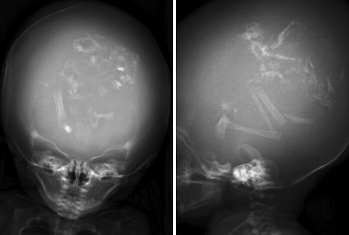 66 Photos Of Human Anatomy Reveal Real Body Features That Seem Almost Impossible At First Glance