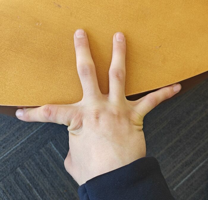 66 Photos Of Human Anatomy Reveal Real Body Features That Seem Almost Impossible At First Glance