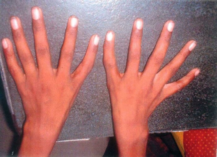 66 Photos Of Human Anatomy Reveal Real Body Features That Seem Almost Impossible At First Glance