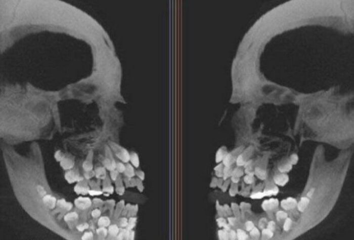 66 Photos Of Human Anatomy Reveal Real Body Features That Seem Almost Impossible At First Glance