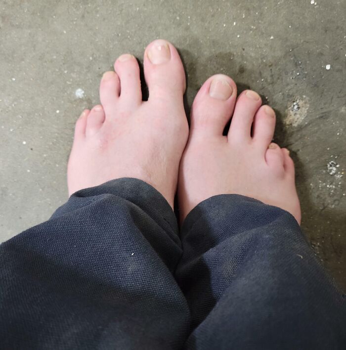 66 Photos Of Human Anatomy Reveal Real Body Features That Seem Almost Impossible At First Glance