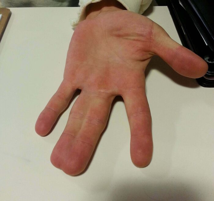 66 Photos Of Human Anatomy Reveal Real Body Features That Seem Almost Impossible At First Glance