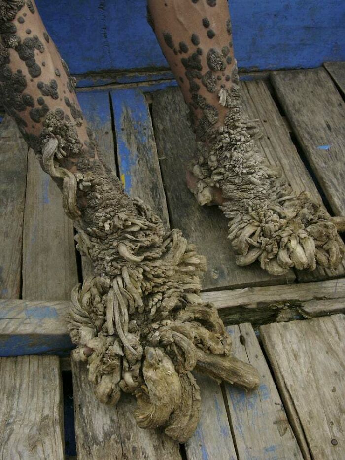 66 Photos Of Human Anatomy Reveal Real Body Features That Seem Almost Impossible At First Glance