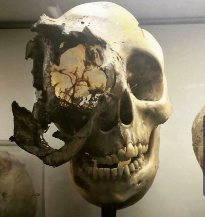 66 Photos Of Human Anatomy Reveal Real Body Features That Seem Almost Impossible At First Glance