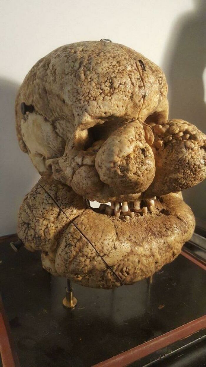 66 Photos Of Human Anatomy Reveal Real Body Features That Seem Almost Impossible At First Glance