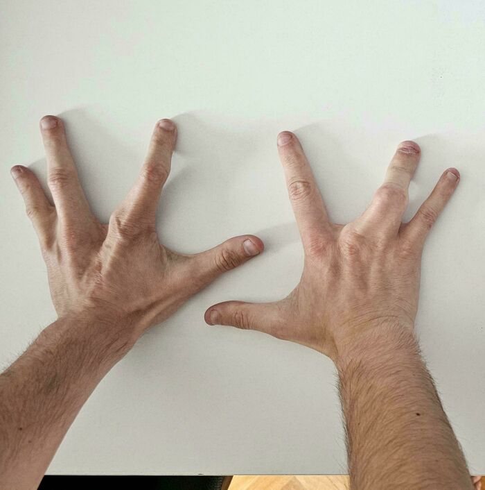 66 Photos Of Human Anatomy Reveal Real Body Features That Seem Almost Impossible At First Glance