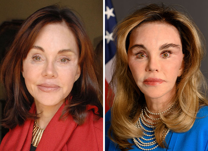 10 Women In Trump’s Circle Who Have Been In The Spotlight For Their Extreme “MAGA Face”&mdash;Here Are The Before-And-After Photos