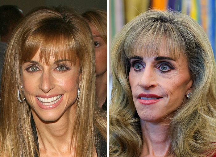 10 Women In Trump’s Circle Who Have Been In The Spotlight For Their Extreme “MAGA Face”&mdash;Here Are The Before-And-After Photos