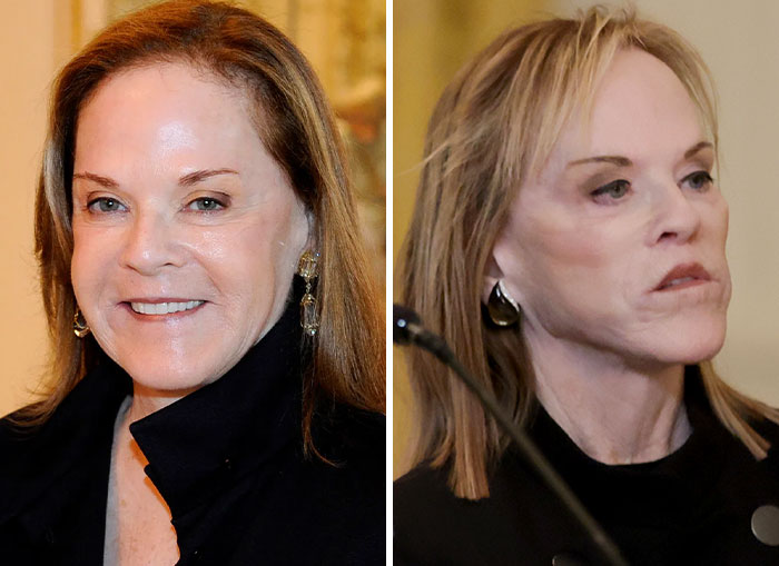 10 Women In Trump’s Circle Who Have Been In The Spotlight For Their Extreme “MAGA Face”&mdash;Here Are The Before-And-After Photos