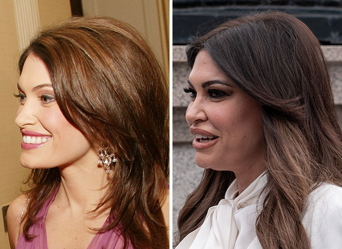 10 Women In Trump’s Circle Who Have Been In The Spotlight For Their Extreme “MAGA Face”&mdash;Here Are The Before-And-After Photos