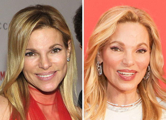 10 Women In Trump’s Circle Who Have Been In The Spotlight For Their Extreme “MAGA Face”&mdash;Here Are The Before-And-After Photos