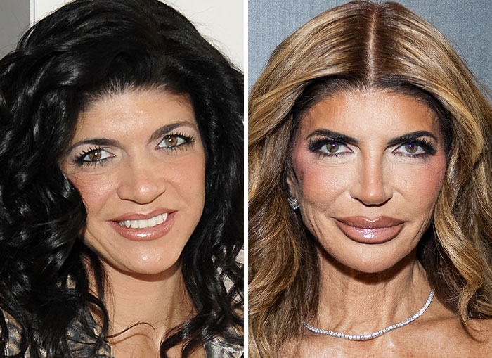 10 Women In Trump’s Circle Who Have Been In The Spotlight For Their Extreme “MAGA Face”&mdash;Here Are The Before-And-After Photos