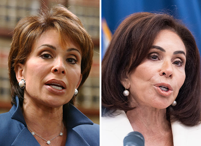 10 Women In Trump’s Circle Who Have Been In The Spotlight For Their Extreme “MAGA Face”&mdash;Here Are The Before-And-After Photos