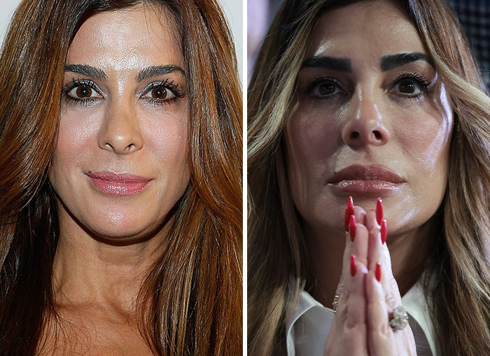 10 Women In Trump’s Circle Who Have Been In The Spotlight For Their Extreme “MAGA Face”&mdash;Here Are The Before-And-After Photos